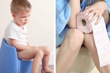 Những biến chứng nguy hiểm của táo bón, người lớn và trẻ em lưu ý