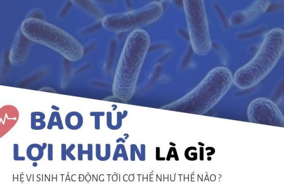 2 nhóm thói quen sinh hoạt phổ biến gây ra táo bón mãn tính